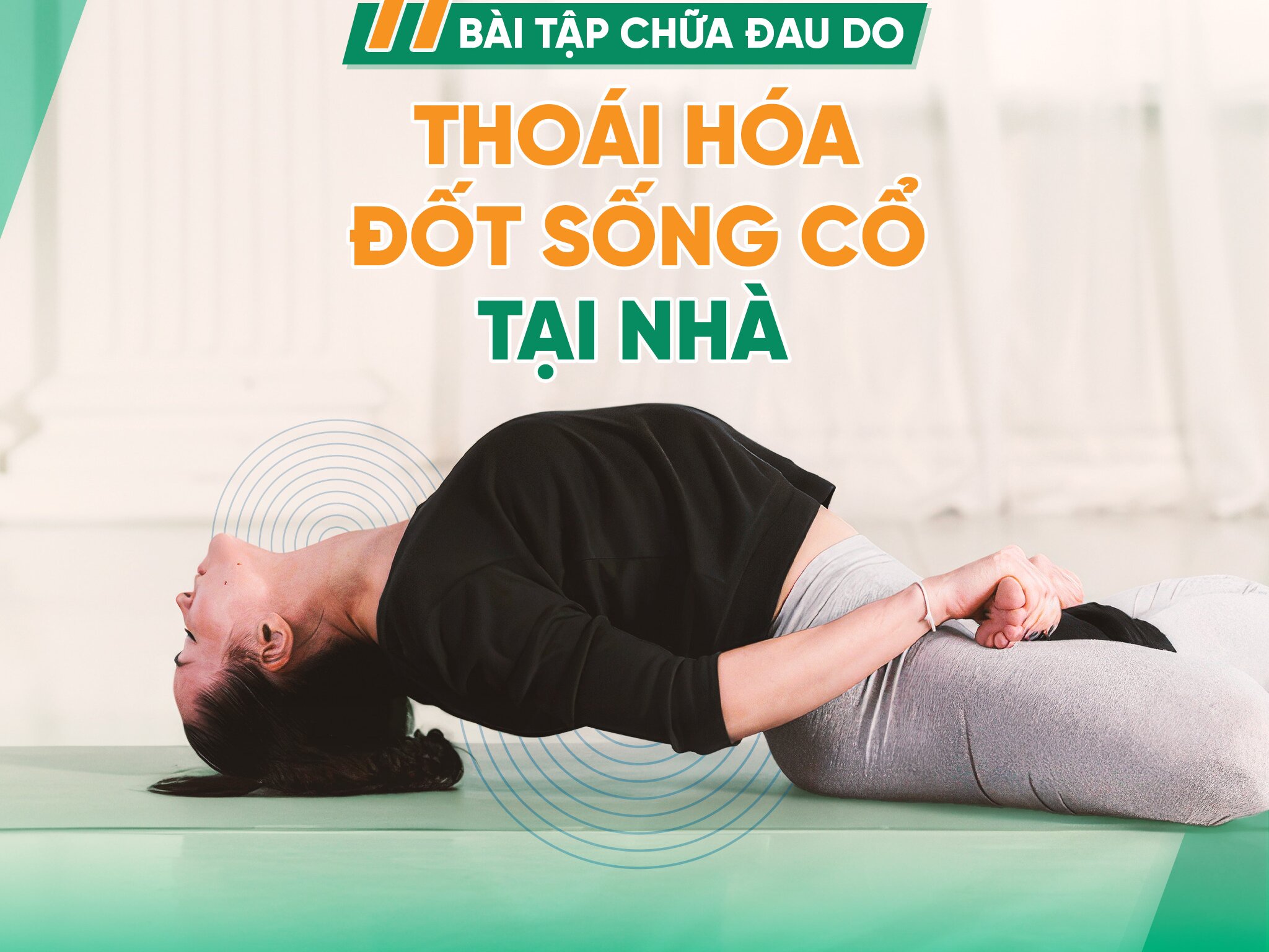 Các bài tập chữa thoái hóa đốt sống cổ