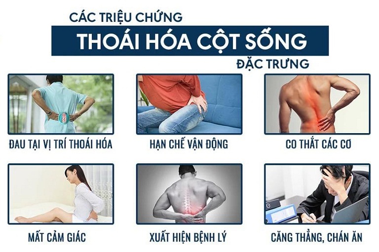 Thoái hóa đốt sống lưng có nguy hiểm không?