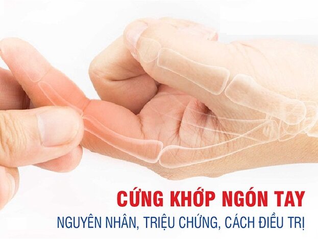 Cứng khớp ngón tay: Nguyên nhân, triệu chứng, cách điều trị
